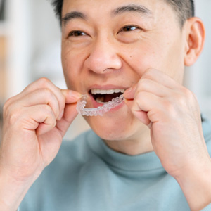 Man smiling while putting on clear aligner