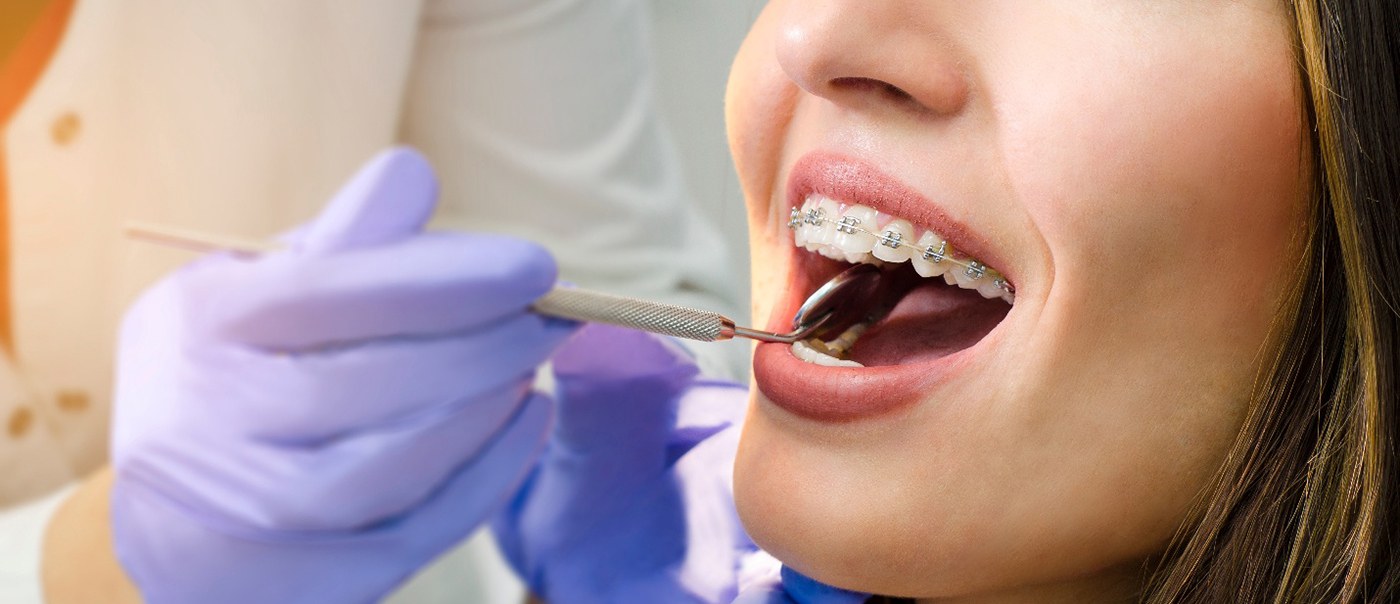 A woman with braces