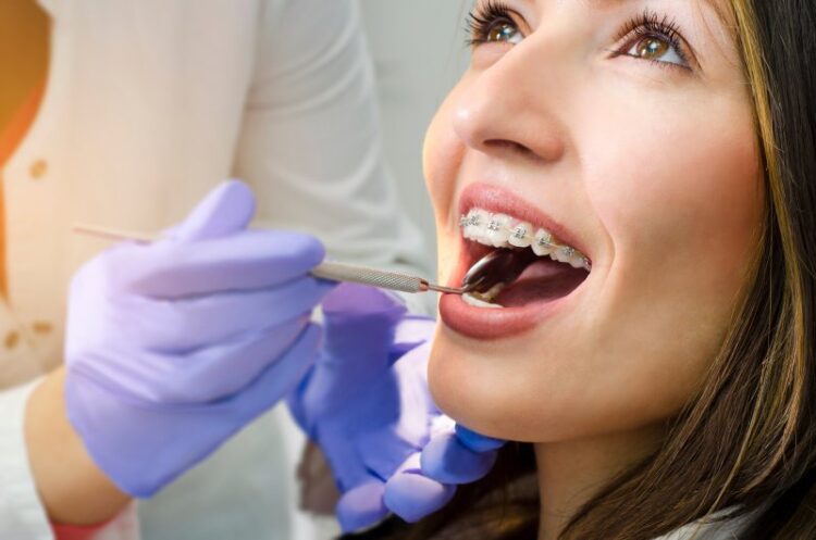 Woman wearing traditional metal braces.