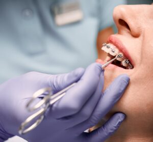 Dentist working on patient with braces.